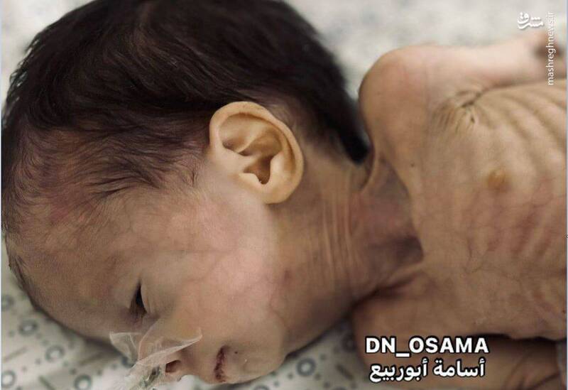 غزه