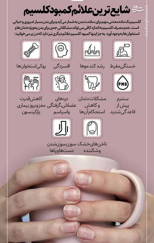 اینفوگرافیک/ شایعترین علائم کمبود کلسیم