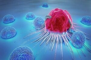 مهم‌ترین نشانه‌های سرطان در مردان