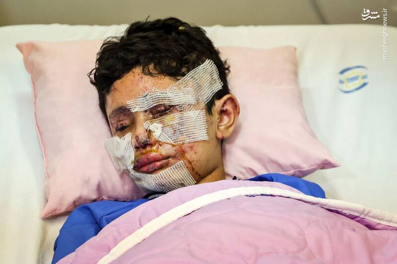 عکس/ عیادت قالیباف از دو کودک مجروحشده در لبنان