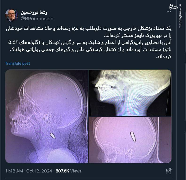 روایت تکاندهنده پزشکان داوطلب از وضعیت کودکان غزه +تصاویر