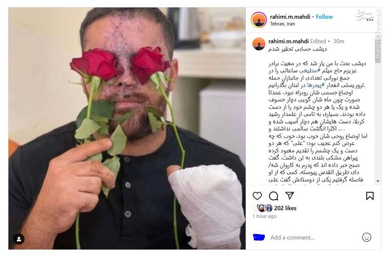 روایتی از دلیرمردان جانباز حزبالله لبنان؛ آرزویش گرفتن انگشتر حضرت آقا بود