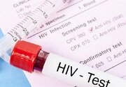 علت عمده ابتلا به بیماری HIV