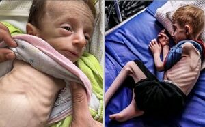 قحطی و گرسنگی؛ عاملی دیگر برای مرگ کودکان غزه