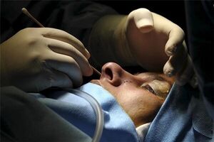 نوجوانان در صف جراحی زیبایی؛ زور پول به اخلاق پزشکی میچربد