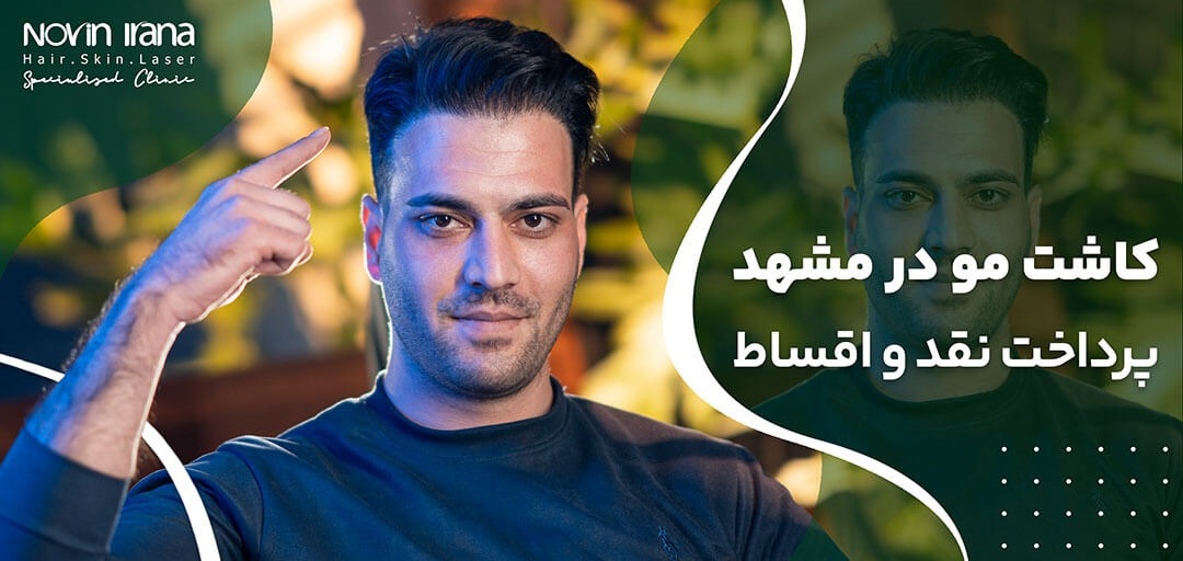 آیا نتایج کاشت مو دائمی است؟ از تبلیغ تا واقعیت