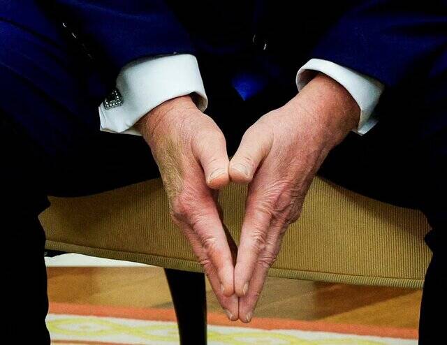 کبودی دست ترامپ بحثبرانگیز شد