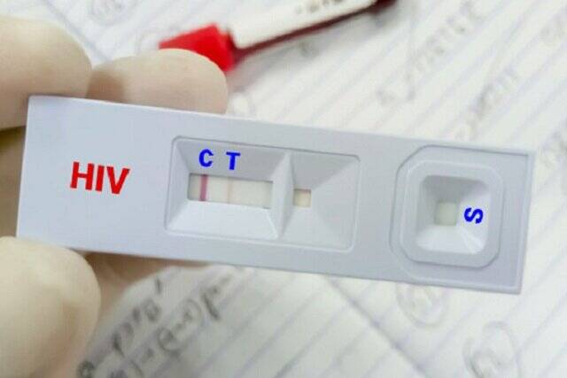 HIV،مبتلا،ويروس،انتقال،بيماري،درمان،ابتلا