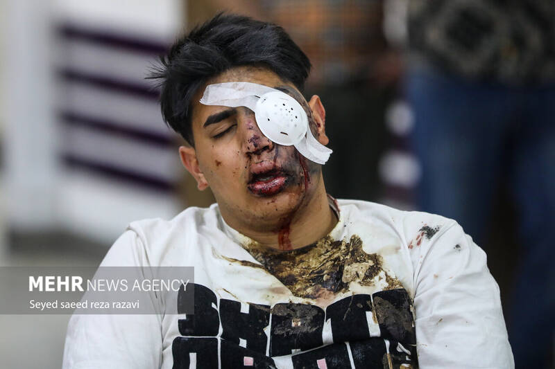 ۱۵ فوتی، ۱۱۵ قطع عضو و ۳۲۷۶ مصدوم به دلیل انفجار مواد محترقه/ تهران با ۶۴۸ مصدوم رکوردار حوادث +عکس و فیلم