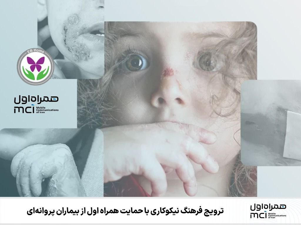 ترویج فرهنگ نیکوکاری با حمایت همراه اول از بیماران پروانهای