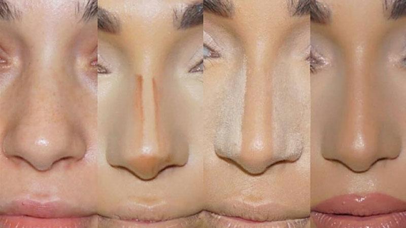 چگونه بینی گوشتی را لاغر کنیم؟! (9 ترفند ساده خانگی + پزشکی)