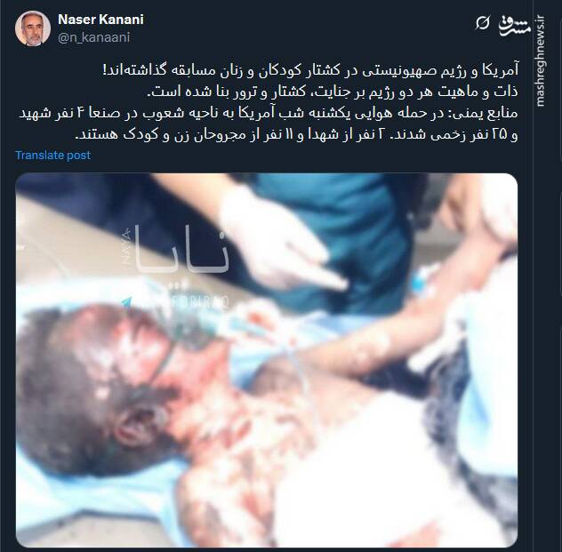 آمریکا و اسرائیل در کشتار کودکان و زنان مسابقه گذاشته‌اند!