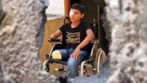 فیلم/ قطع عضو شدن کودکان فلسطینی بر اثر حملات رژیم صهیونیستی