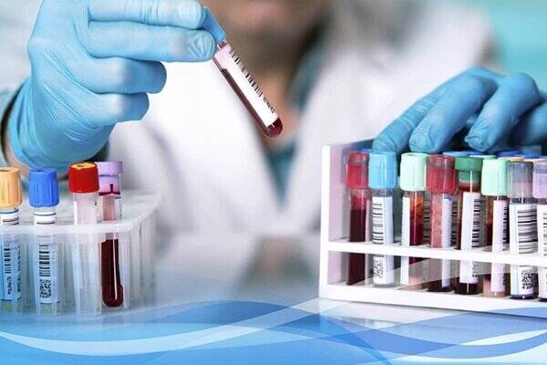 آزمايشگاه،پزشكي،مراجعه،بهداشت،القايي،سلامت،كشور،مراجعات،مطب، ...