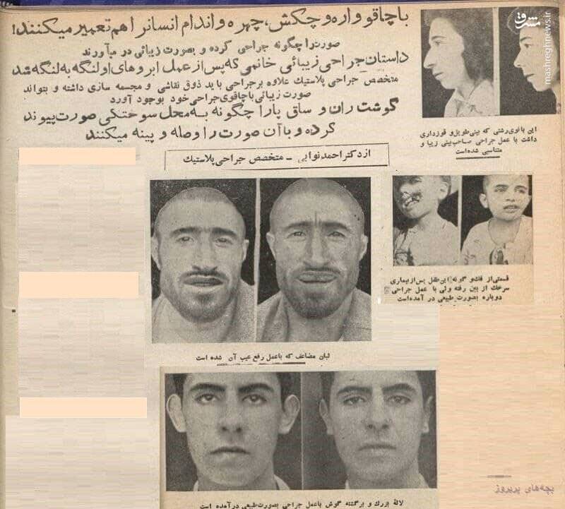 شیوع عوارض عفونی ناشی لیفت چربی به صورت/ وقتی زنجیرهای زیبایی و سادگی در آرایشگاهها/ صورت بالشتیها بخوانند