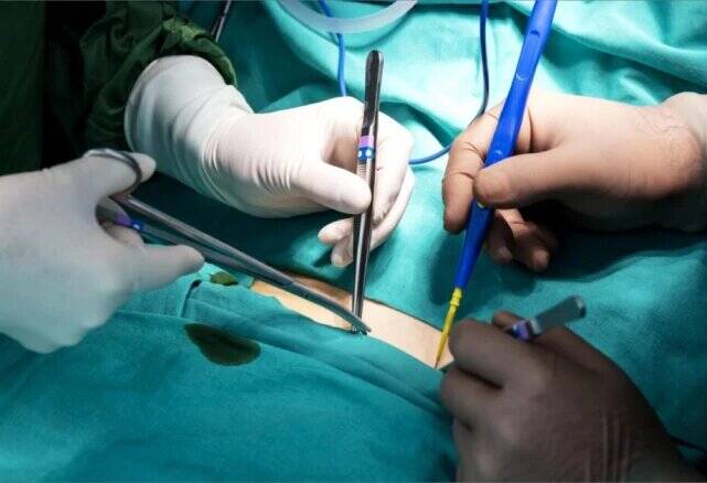 از بالون تا پیکرتراشی؛ درمان یا ترفند تبلیغاتی؟