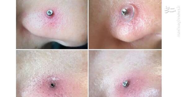 ترندهای دردناک+ عکس و فیلم