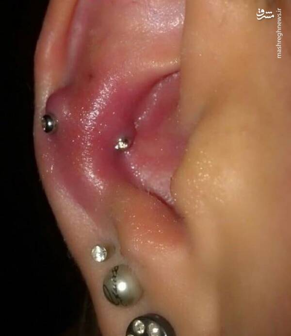 ترندهای دردناک+ عکس و فیلم