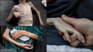 شهادت ۶۰ کودک در غزه در ۶۰۰ روز گذشته به دلیل سوء تغذیه