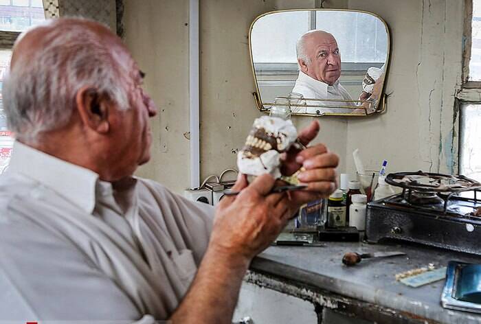 پشت پرده دندانسازی ارزان؛ از مواد درجه چندم تا مشتریان ناآگاه/ دندانسازان زیرزمینی؛ صنف پرسود در سایه قانون!