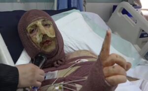 فیلم/ مصاحبه با یکی از پرنسل مجروح شده پدافند هوایی ارتش