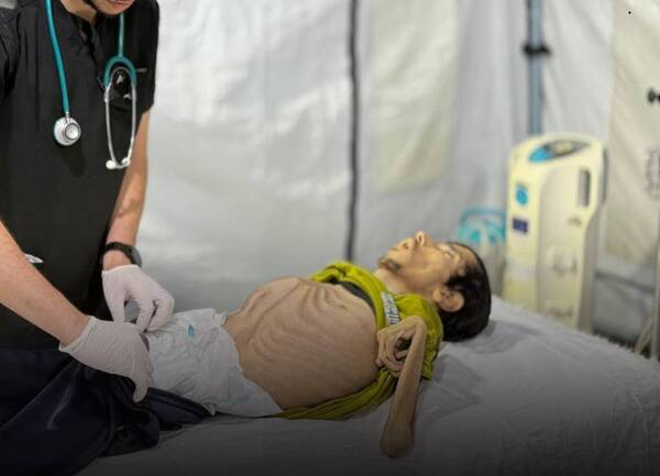 غزه،فلسطيني،غذا،ايوب،نوار،جوان،شرايط،گزارش،سوءتغذيه