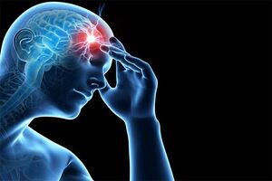 سکتههای مغزی مکرر میتوانند و زوال عقل عروقی