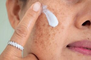 محافظت از پوست در طب سنتی ایرانی