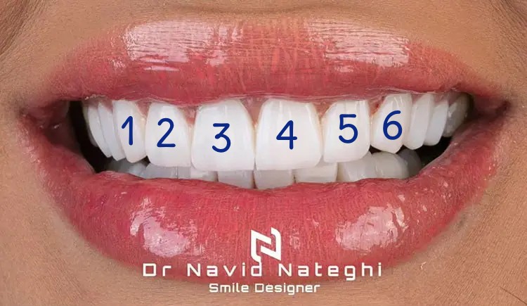 هر واحد کامپوزیت چند دندان است؟ | پاسخ جامع + راهنمای هزینه 1404