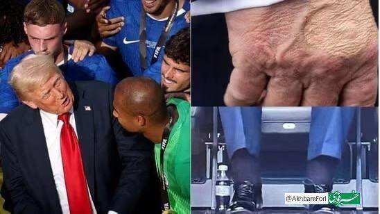 كاخ،سفيد،وضعيت،وريدي،پاهاي،مزمن