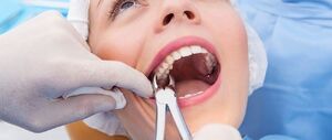 لحظه هولناک انفجار دستگاه دندانپزشکی در دهان بیمار + فیلم