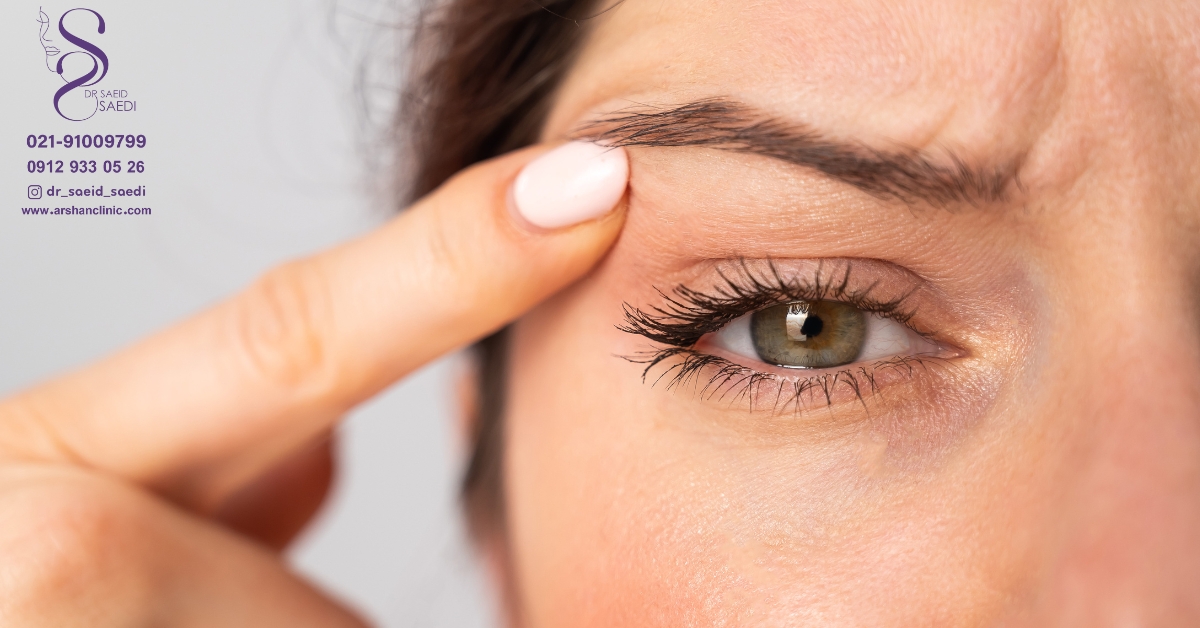 نتیجه عمل بلفاروپلاستی کی مشخص می شود