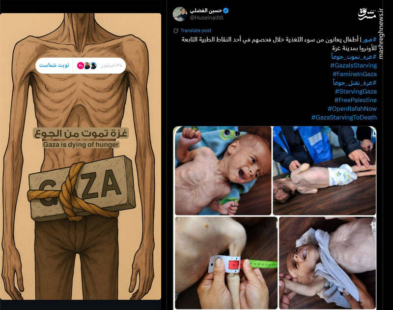 جولان سوءتغذیه کشنده در غزه/