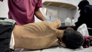 جان باختن ۶۰ کودک فلسطینی بر اثر سوءتغذیه تاکنون بیش از ۶۰ کودک در غزه براثر سوءتغذیه جان خود را از دست دادهاند
