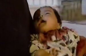 شهادت کودک فلسطینی در حمله به چادر آوارگان در خان‌یونس