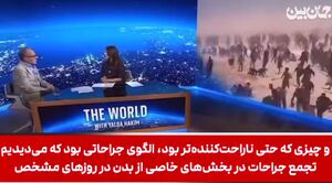 گزارشی تکان‌دهنده از جنایت صهیونیست‌ها، توسط پزشکان بی‌مرز+ فیلم