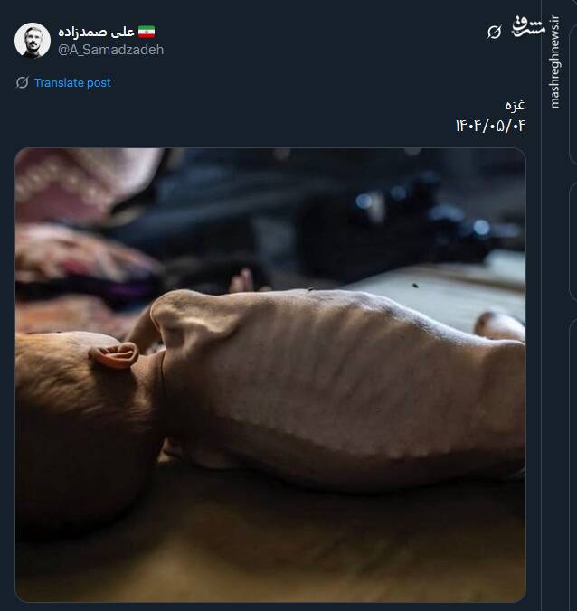 وضعیت این روزهای کودکان غزه+ عکس