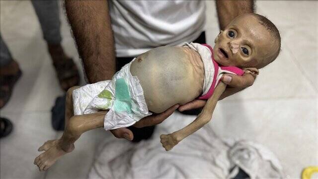 حتی ترامپ هم به قحطی در غزه اذعان کرد