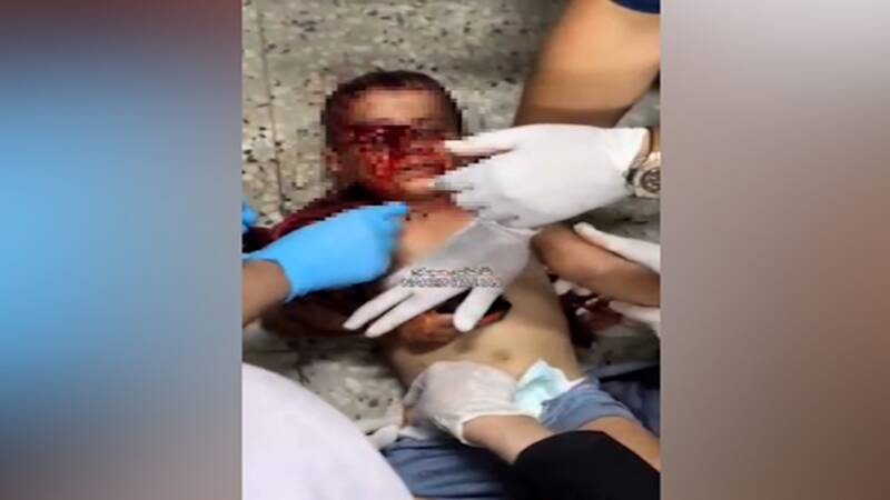 زخمی شدن کودک فلسطینی در بمباران تل الهوی