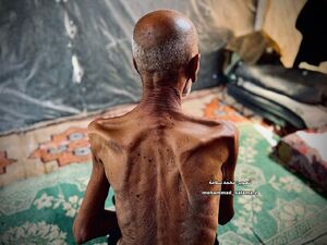 محاصره غذایی اسرائیل چگونه غزه را می‌کشد؟