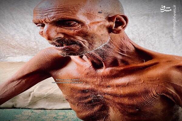 عکس/ تاثیرات گرسنگی بر موذن مسجد صحابه در جنوب غزه