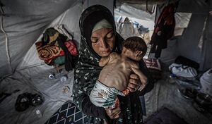 فاجعه خاموش در غزه/ گسترش نگران‌کننده فلج کودکان غزه به‌سبب گرسنگی و آلودگی آب