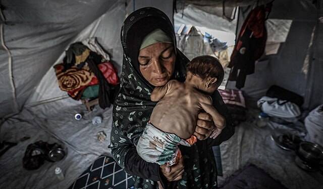 فاجعه خاموش در غزه/ گسترش نگرانکننده فلج کودکان غزه بهسبب گرسنگی و آلودگی آب