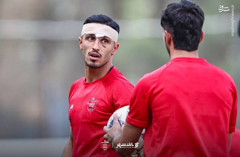 واضح‌ترین تصویر از جراحت چشم مهاجم پرسپولیس