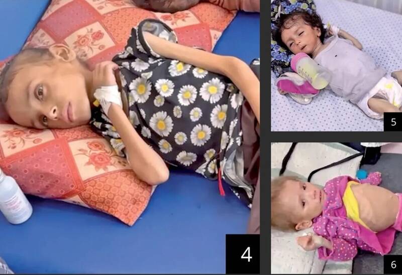 اذعان «هاآرتص» به فجایع غزه؛ همه جا را گرسنگی فراگرفته است+ تصاویر