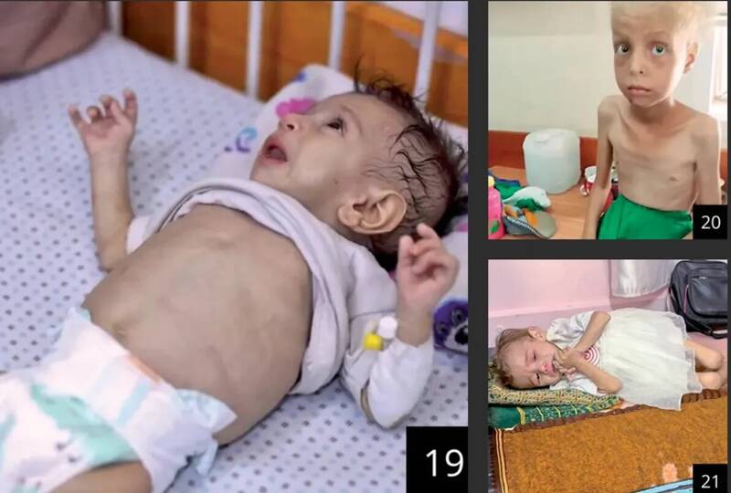 اذعان «هاآرتص» به فجایع غزه؛ همه جا را گرسنگی فراگرفته است+ تصاویر