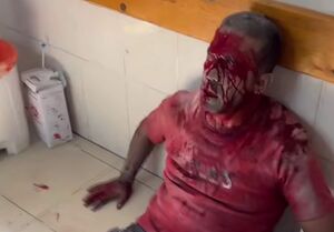 مجروحیت شدید عکاس رویترز در حمله اسرائیل به بیمارستان ناصر