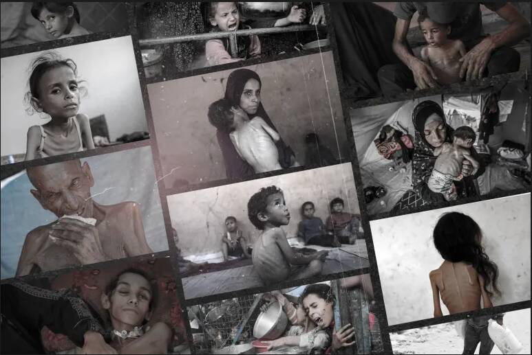 نفر،سازمان،نوشت،جهاني،درصد،قحطي،غزه،غذايي،تأكيد،ملل،كودكان،گ ...