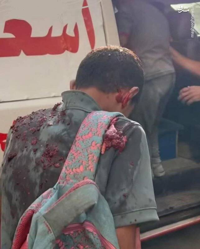 تصویری دیگر از جنایات سهمگین اسرائیل در غزه