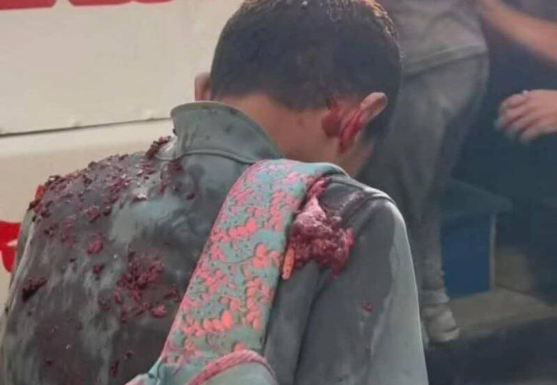 تصویری دیگر از جنایات سهمگین اسرائیل در غزه